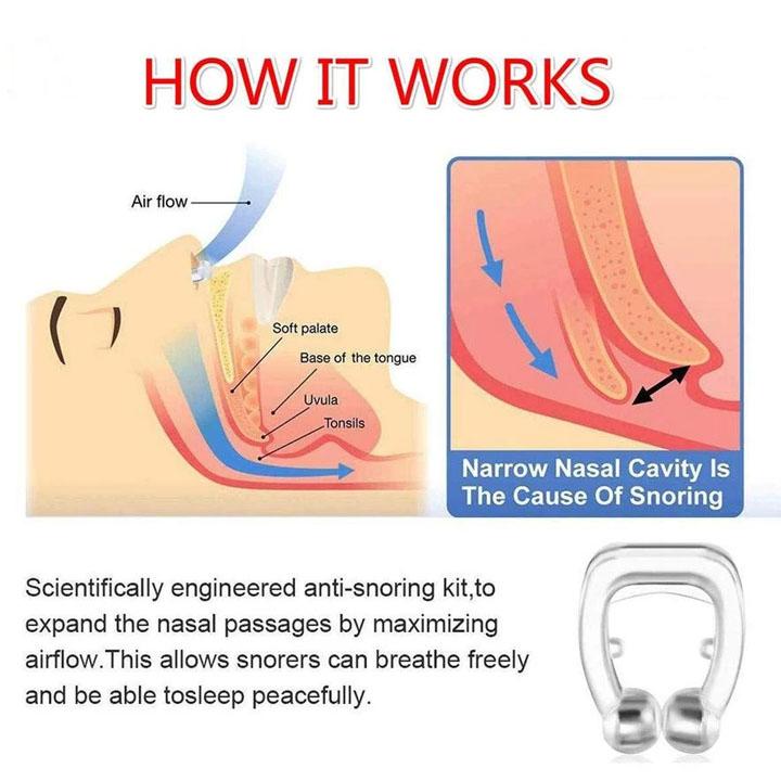 338 Snore Free Nose Clip (Anti Snoring Device) - 1pc - Trendex
