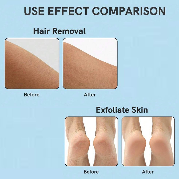 Nano Hair Remover For Arms Legs Back One Sided Skin Hair Remover (1 Pc) - Trendex