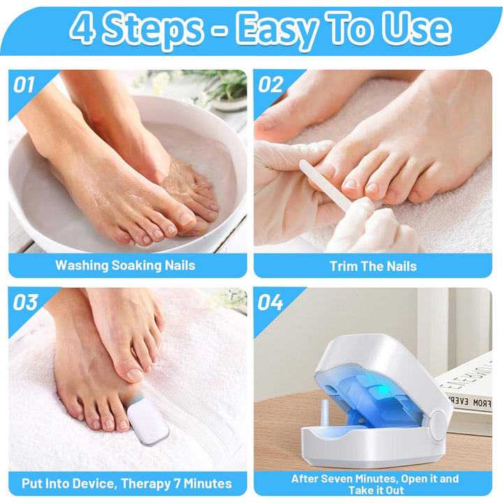 12915 Rechargeable Nail Fungus Treatment For Toenail Toe Nail Fungal Treatment Nail Fungus Laser Device Anti-fungal Nail Treatment For Hand  Feet Infections Remover For Home Use - Trendex