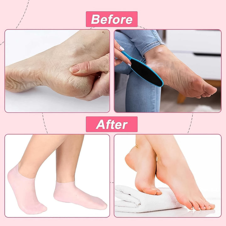 Silicone Moisturizing Socks (1 Pair) - Trendex